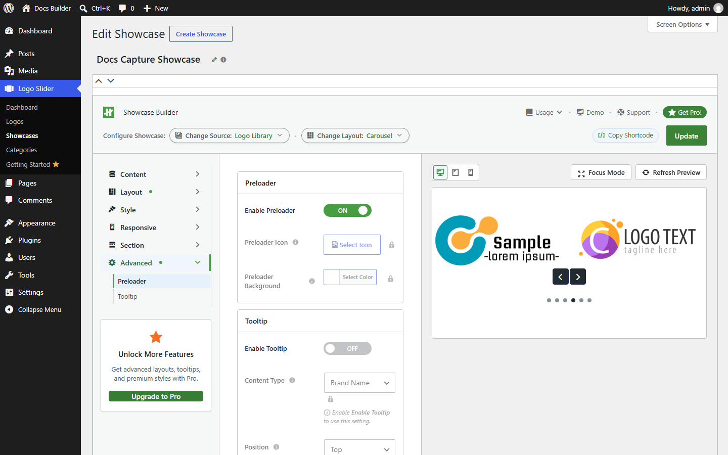Showcase Builder — Advanced tab